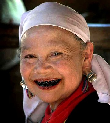 Effect of Chewing Betelnut